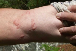 Lexikon: Stiche von Ameisen aus der Gattung <i>Tetramorium</i>.